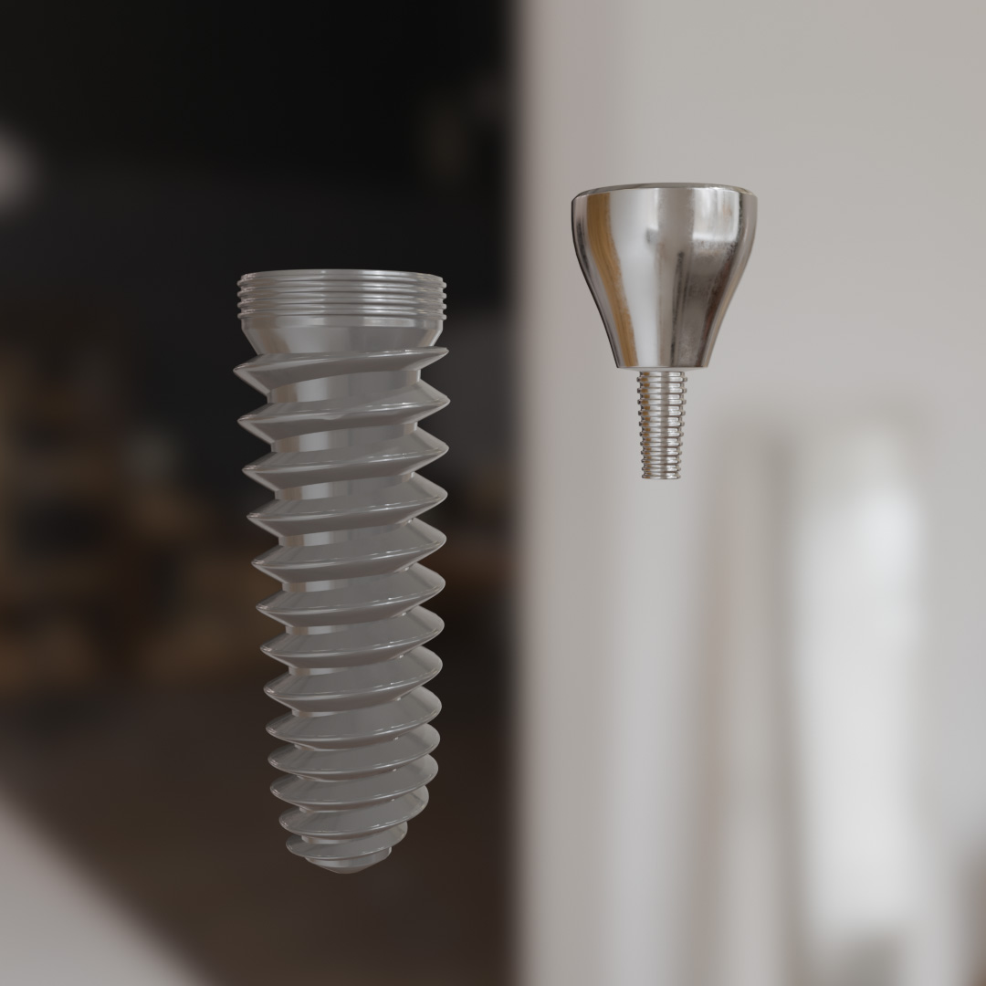 Implant Fixture